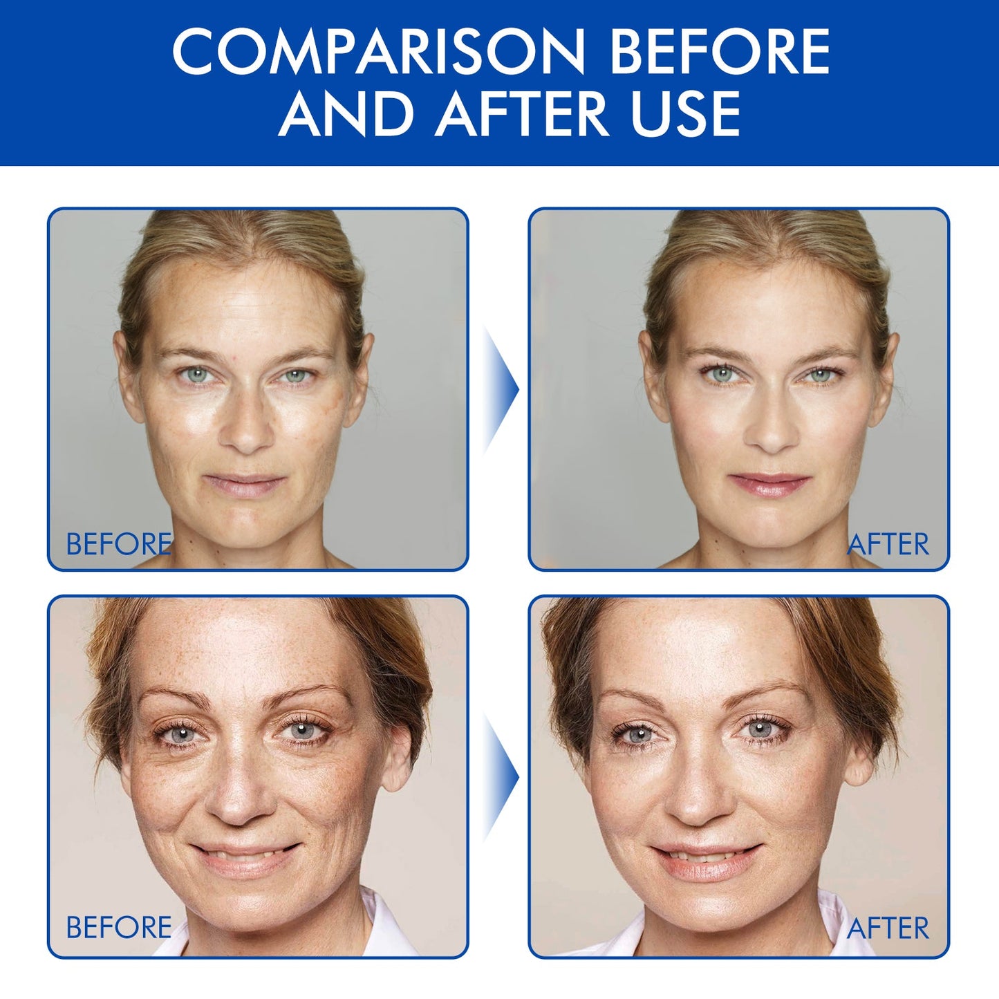 🔥🔥🔥 Last Day 79% OFF Firming Anti-Aging Facial Serum🔥🔥🔥