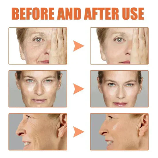 🎁Last Day Promotion🎁-Clostridium botulinum Face Serum