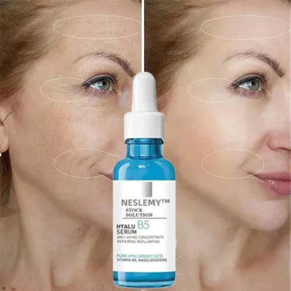 🎁Last Day Promotion🎁-Clostridium botulinum Face Serum