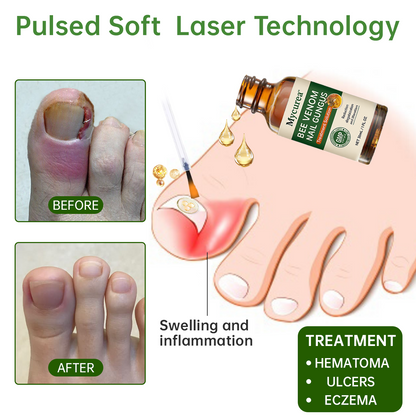 💔 Mycurea™ Bee Venom Nail Fungus Treatment Liquid
